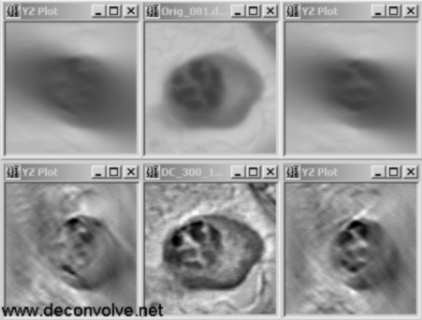 optical sectioning microscopy YZ slice