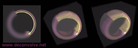 Deconvolution of vesicle 3D rendering